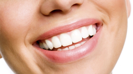 Smile Dental Mosman Park Hero Image