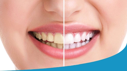 Devonport Dental Care Hero Image