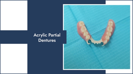 Right Dentures Hero Image