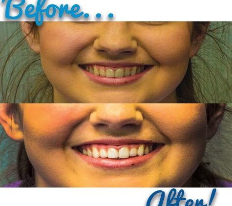 Gulfside Dental & Orthodontics - Beaumont - Beaumont, TX