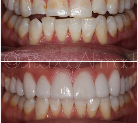 Dr. Borzoo Ahmadi DDS - West Hollywood, CA