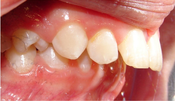Active Orthodontics - Bundaberg South, QLD