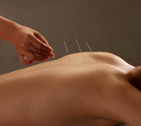 Blue Lotus Acupuncture - Jacksonville Beach, FL