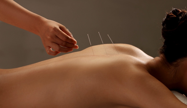 Four Seasons Acupuncture - Sun City, AZ. Acupuncture