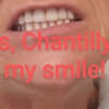 Affordable Dentures & Implants gallery