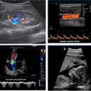 Ultrasound mobile services - Ultrasonic Equipment & Supplies