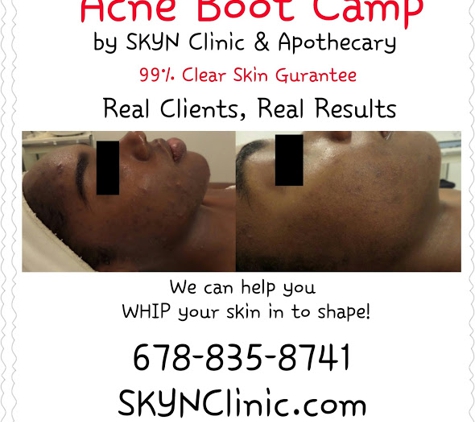 SKYN Clinic & Apothecary - Suwanee, GA