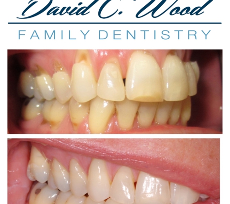 David Wood Family Dentistry - Carmel, IN