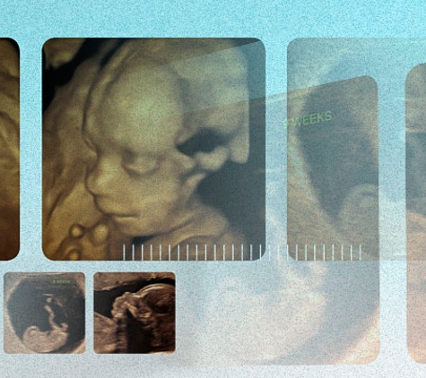 Melbourne Ultrasound For Women - Hampton, VIC