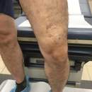 Chicago Vein Care Center - Skin Care