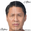 Kim Facial Plastic Surgery gallery