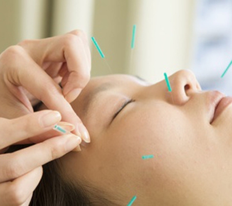 Brisbane Golden TCM Acupuncture & Chinese Herbal Medicine - Spring Hill, QLD
