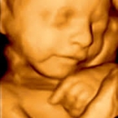 Baby's First Photos - Medical & Dental X-Ray Labs