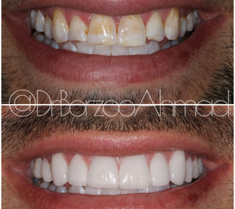 Dr. Borzoo Ahmadi DDS - West Hollywood, CA