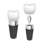 Dental Implants Factory