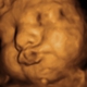 Conceived Revelations 3D/4D Ultrasound Studio