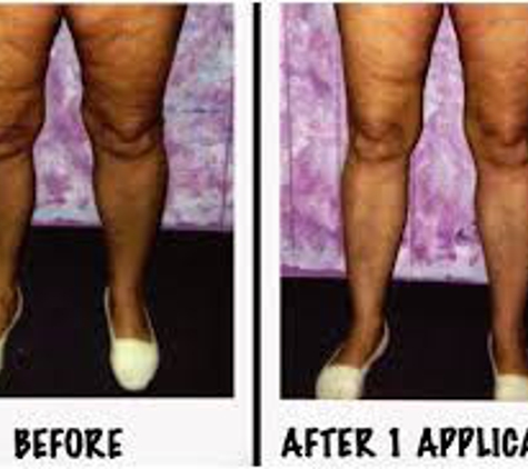 Vels Body Wraps - Wilmington, DE