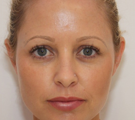 OPM® Organic Permanent Makeup - Los Angeles, CA. After opm