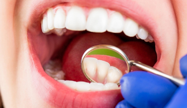 Aberdeen Dental Care - Geelong West, VIC