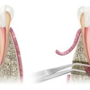 Oral Surgery Specialists of New York gallery