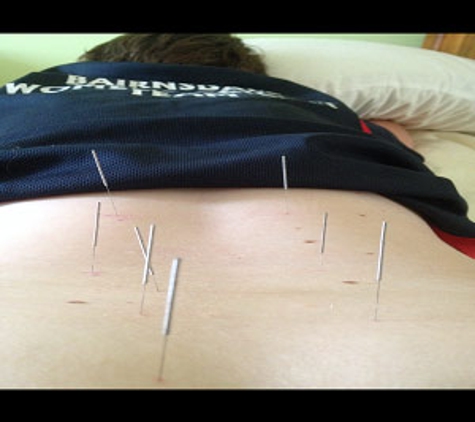 Sunshine's Acupuncture and Chinese Medicine Clinic - Bairnsdale, VIC