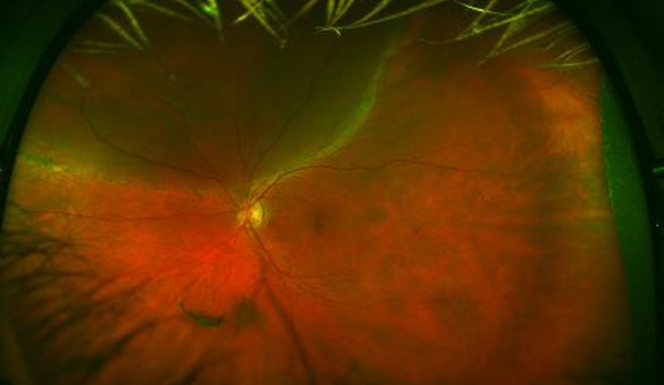 Sydney Retina - Sydney, NSW