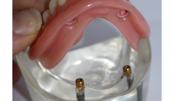 Advance Oral Denture Clinic - Mooloolaba, QLD