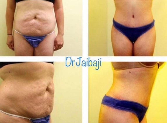 Jaibaji Plastic Surgery - San Diego, CA