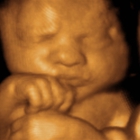 A Little Insight 3d 4d Ultrasound