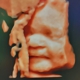 Love At First Sight 3D/4D Ultrasound Imaging Studio