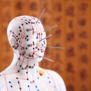 Newtown Acupuncture and Wellness - Acupuncture