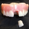 Denture Repairs by Lori gallery