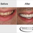 Smile More Today - Dentists