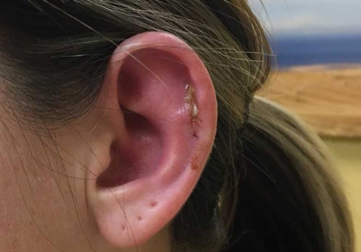 ear piercing pagoda near me