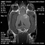 Companion MRI (CICNE)