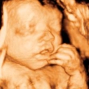 Clear Image 4D Ultrasound : Staten Island - Maternity Clothes