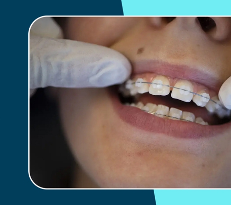 Orthodontix Northbridge - Northbridge, NSW. Leading Braces Specialist