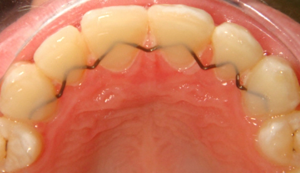 Hunter Valley Orthodontics - Salamander Bay, NSW