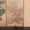 Phoenix Tattoo Removal gallery