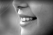Jere, Deepali - Cosmetic Dentistry