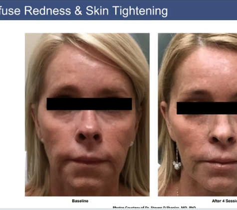 Clean Laser Clinics - Teneriffe, QLD