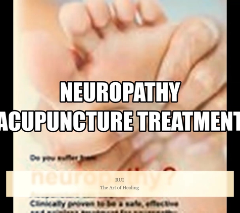 Acu-Care Acupuncture Center - Rochester, NY. Neuropathy Acupuncture Care