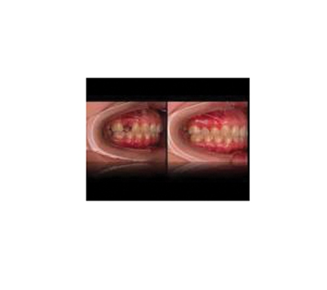 Affordable Denture Clinic - East Geelong, VIC