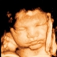 Clear Image 4D Ultrasound