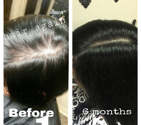 Hair Again Certified Hair Loss Specialists - San Antonio, TX