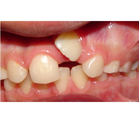 Active Orthodontics - Pialba, QLD
