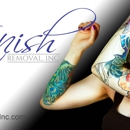 Vanish, Inc. - Tattoo Removal