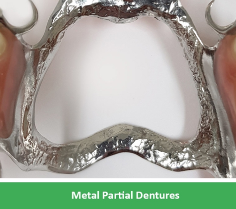 Complete Denture Care - Wantirna, VIC. Metal Partial Dentures