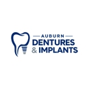 Auburn Dentures & Implants - Implant Dentistry