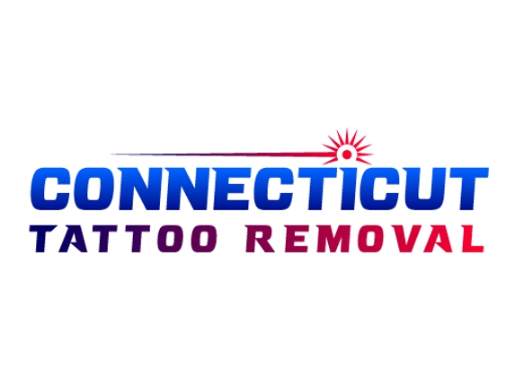 Connecticut Tattoo Removal - Branford, CT